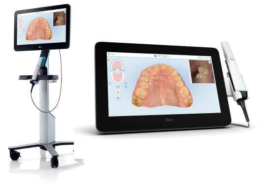 Itero Lumina Scanner